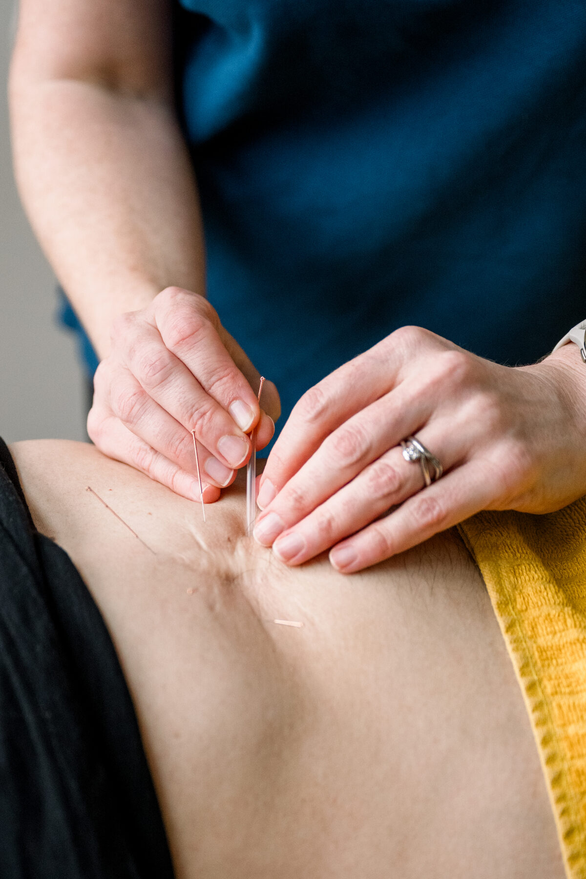 Professional Physiotherapy
